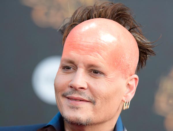 10 Best Hairstyles for Balding Men