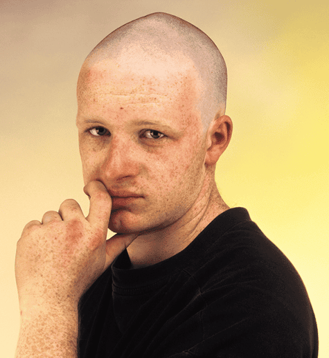 Figure 10. Shamed by your lack of hair?