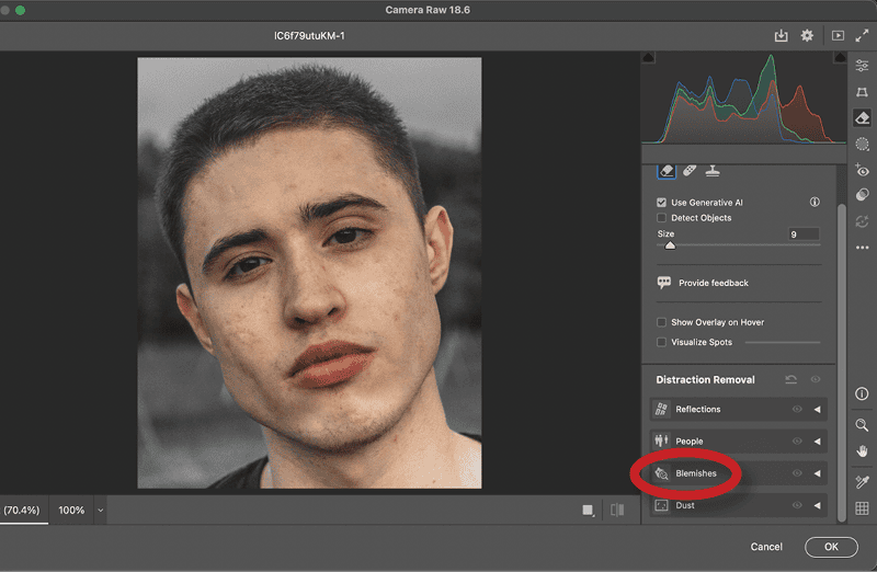 Figure 1. The new Blemish Removal tool is found in Camera Raw, in the Eraser section. 