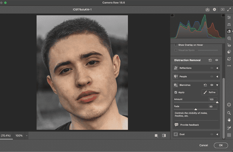 Figure 2. Clicking the Blemish button instantly removes skin blemishes.